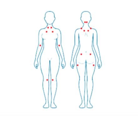 Qué es la fibromialgia